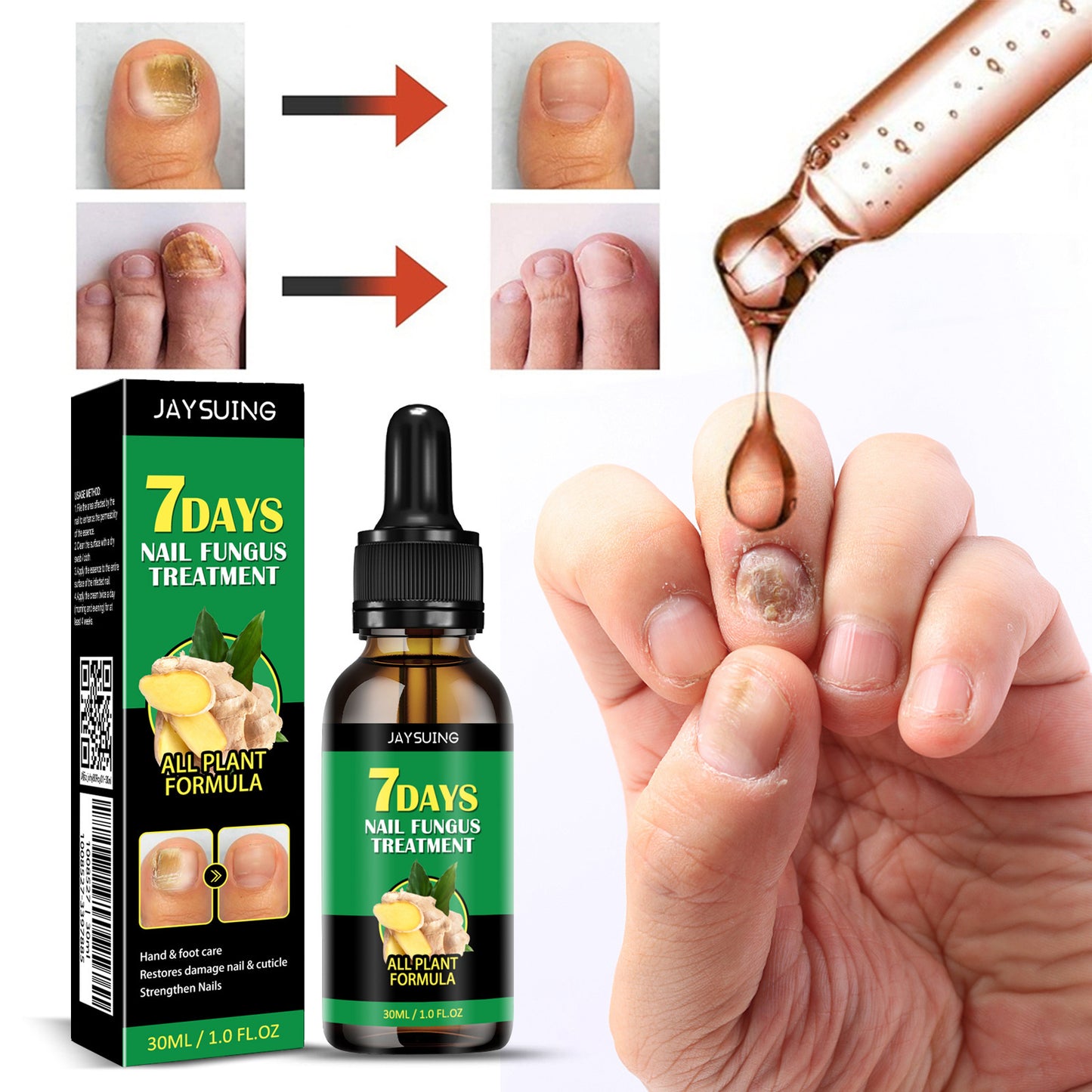 Kit Antihongos para Uñas