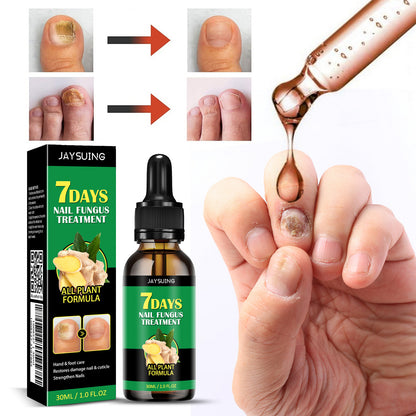 Kit Antihongos para Uñas